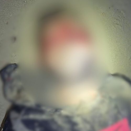  1 de 1Homem, não identificado, foi encontrado morto em São Vicente (SP) — Foto: g1 Santos 